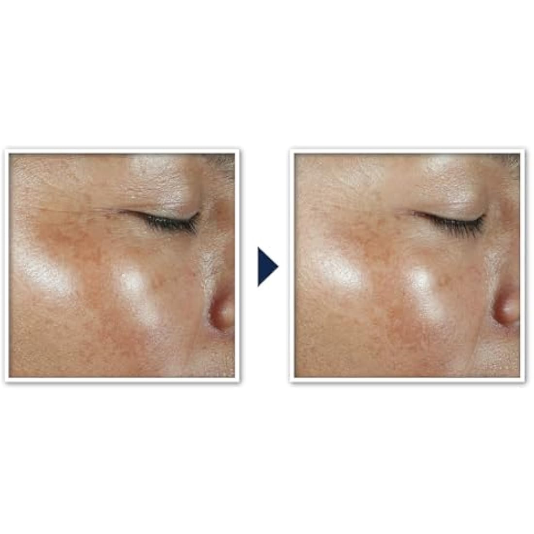 RoC Multi Correxion Revive + Glow Moisturiser SPF 30 | Light Face Cream with Vitamin C | 50 ml