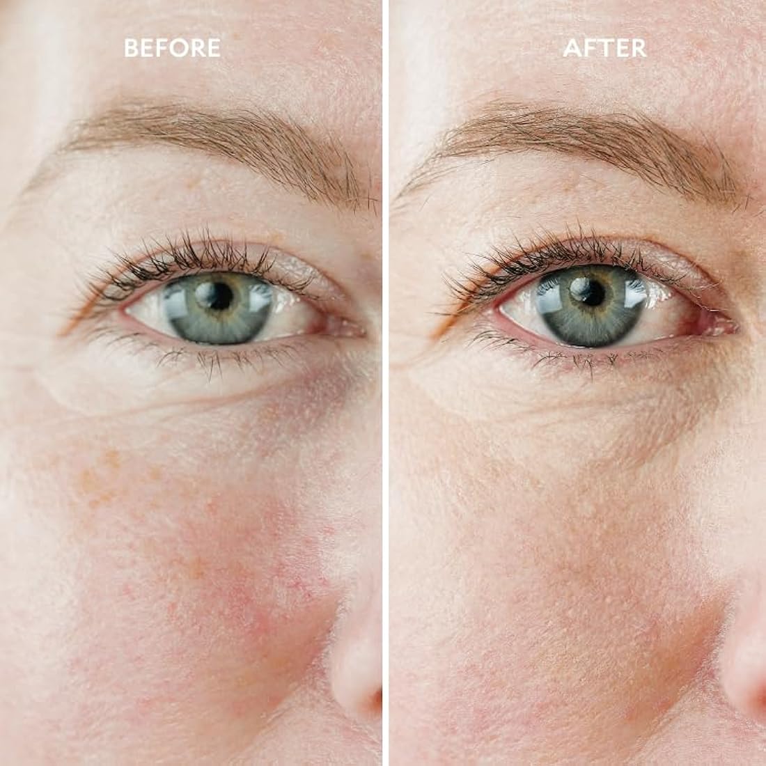 Gatineau - Miracle Eye Contour Cream, Conceal Dark Circles, Hydrating with Hyaluronic Acid & Vitamin E (11ml x 2)