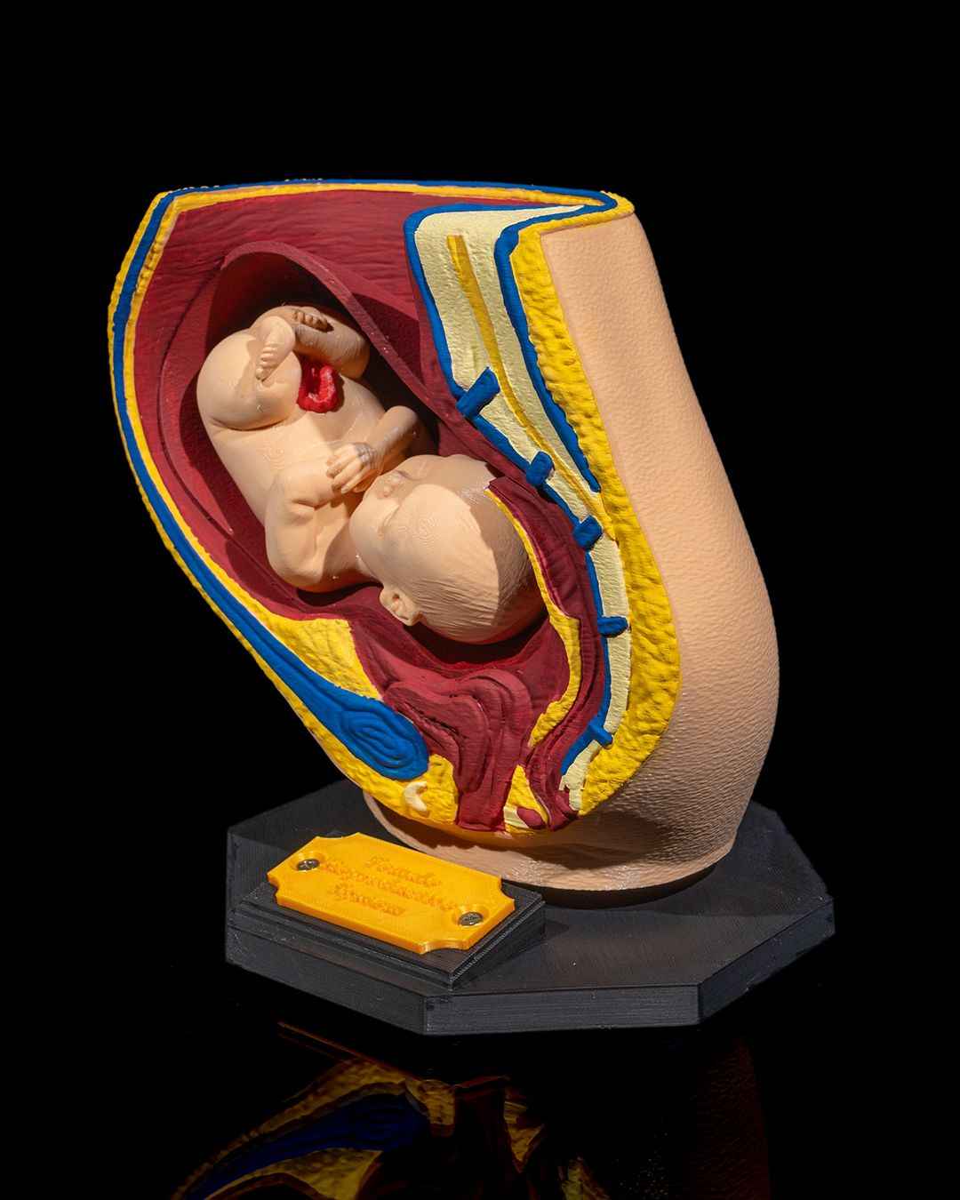 Female Reproduction educational model