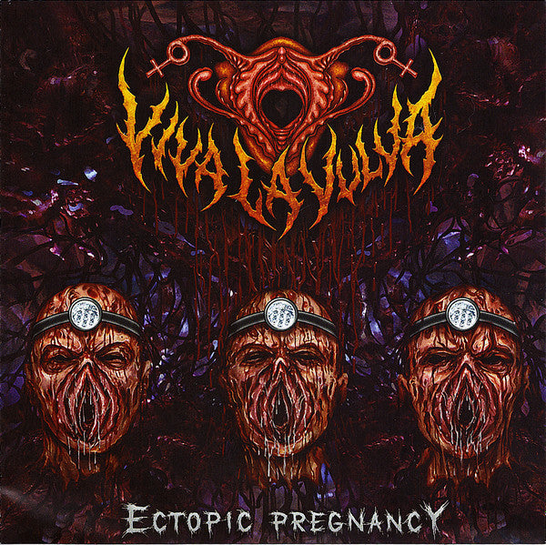 Viva La Vulva - Ectopic Pregnancy