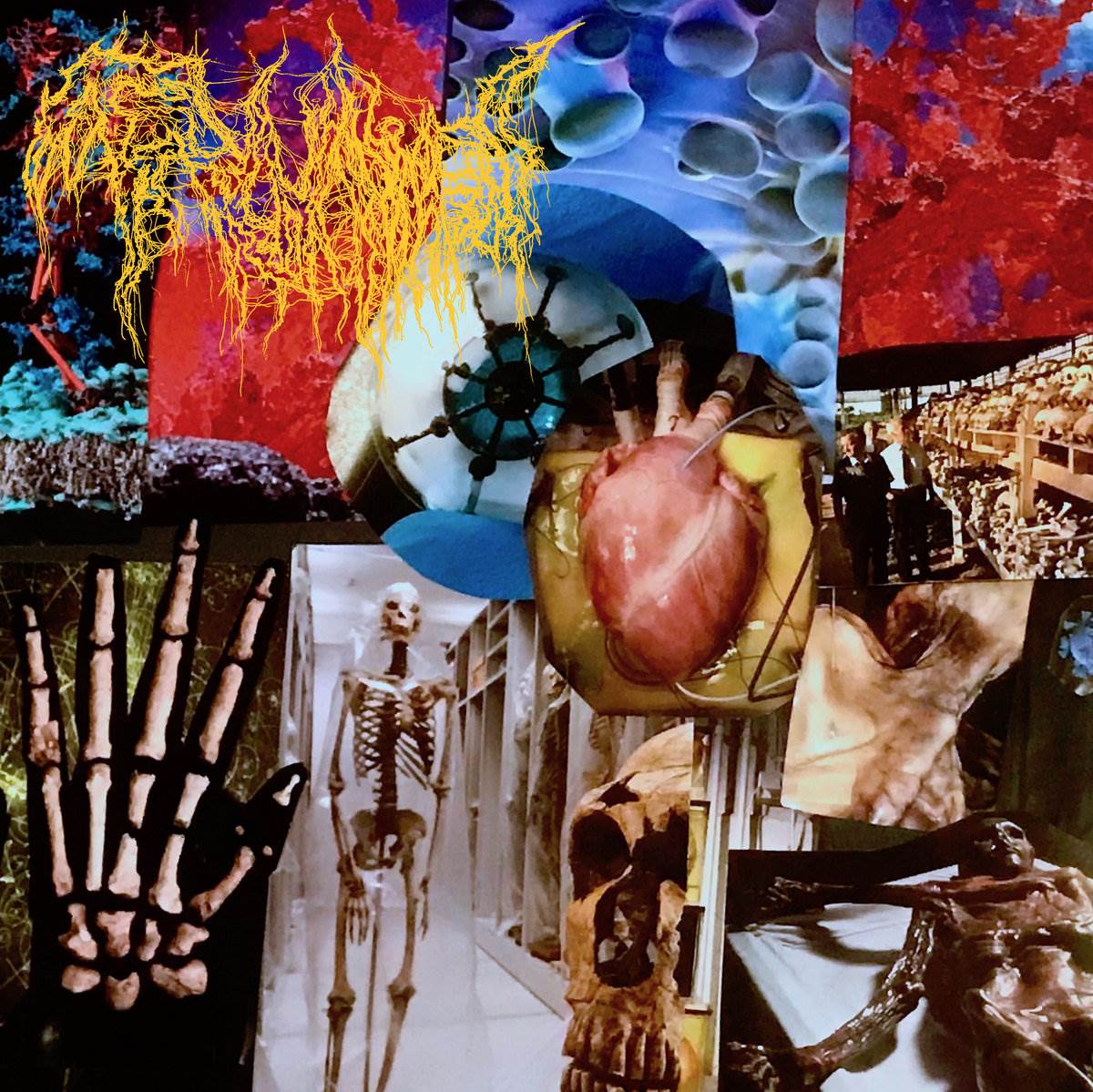 Trichomoniasis - Harvest of the Killing Fields CD