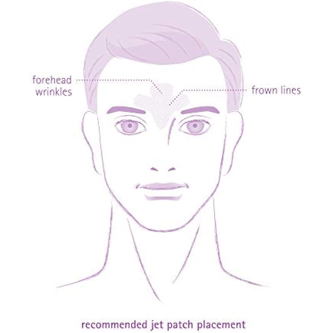 Toute Nuit Facial Wrinkle Flattening Patches - JET Extra Large UNISEX Frown Lines Plus (Anti-Wrinkle Patches/Face Tape)