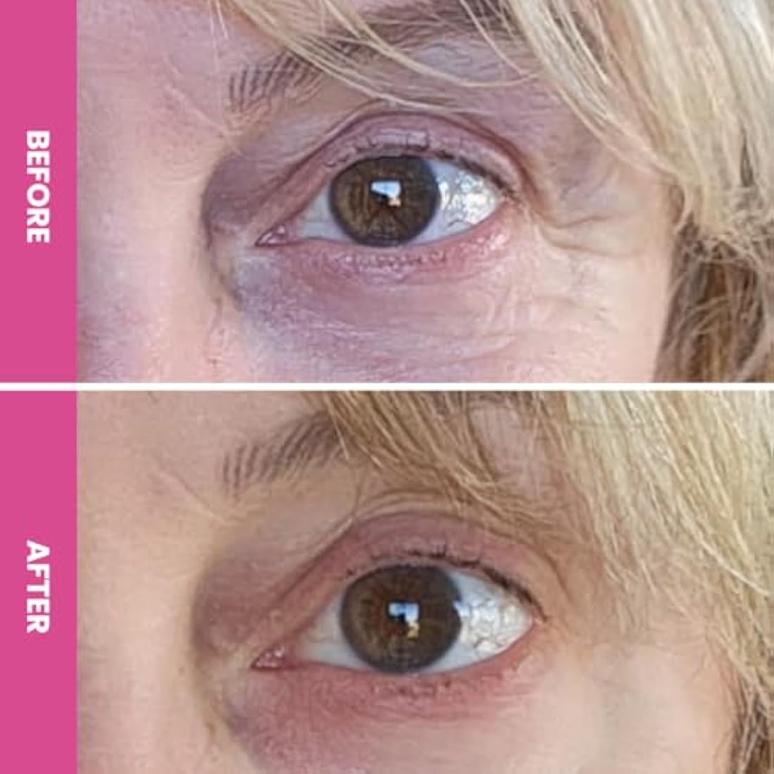 Prime Prometics PrimeEyes Hydrate Under Eye Cream for Mature Women – Hydrating Eye Cream for Dark Circles and Wrinkle Repair – Soft, Glowing & Healthy Under Eyes