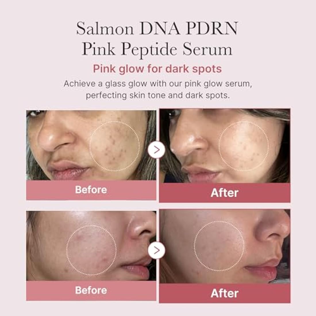 medicube - PDRN Pink Peptide Serum 30ml