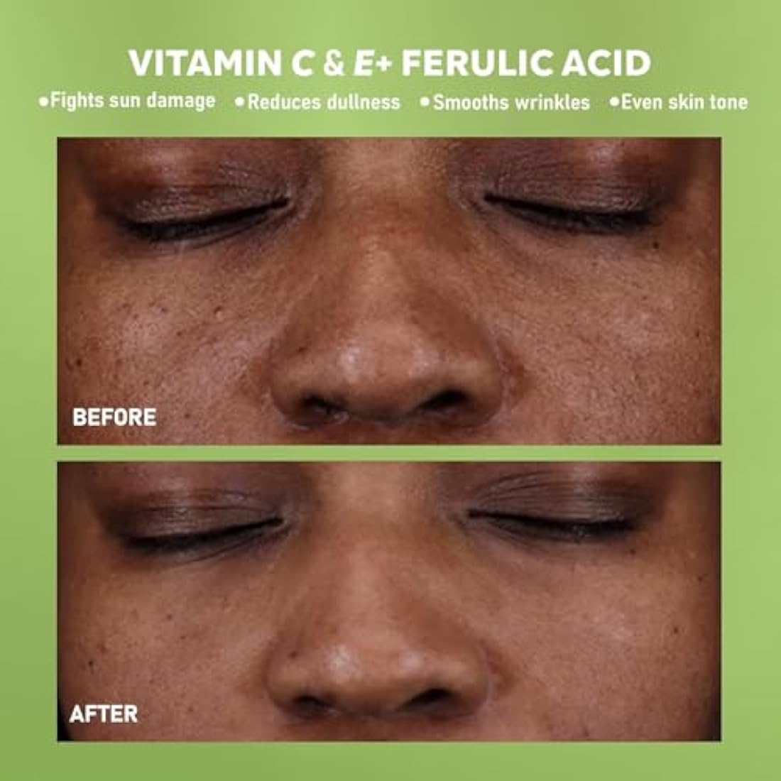 DERMAdoctor Kakadu C Vitamin C Serum – Brightening Anti-Aging Face Serum for Dark Spots, Uneven Skin Tone & Fine Lines – 30 Millilitres (20282-7)
