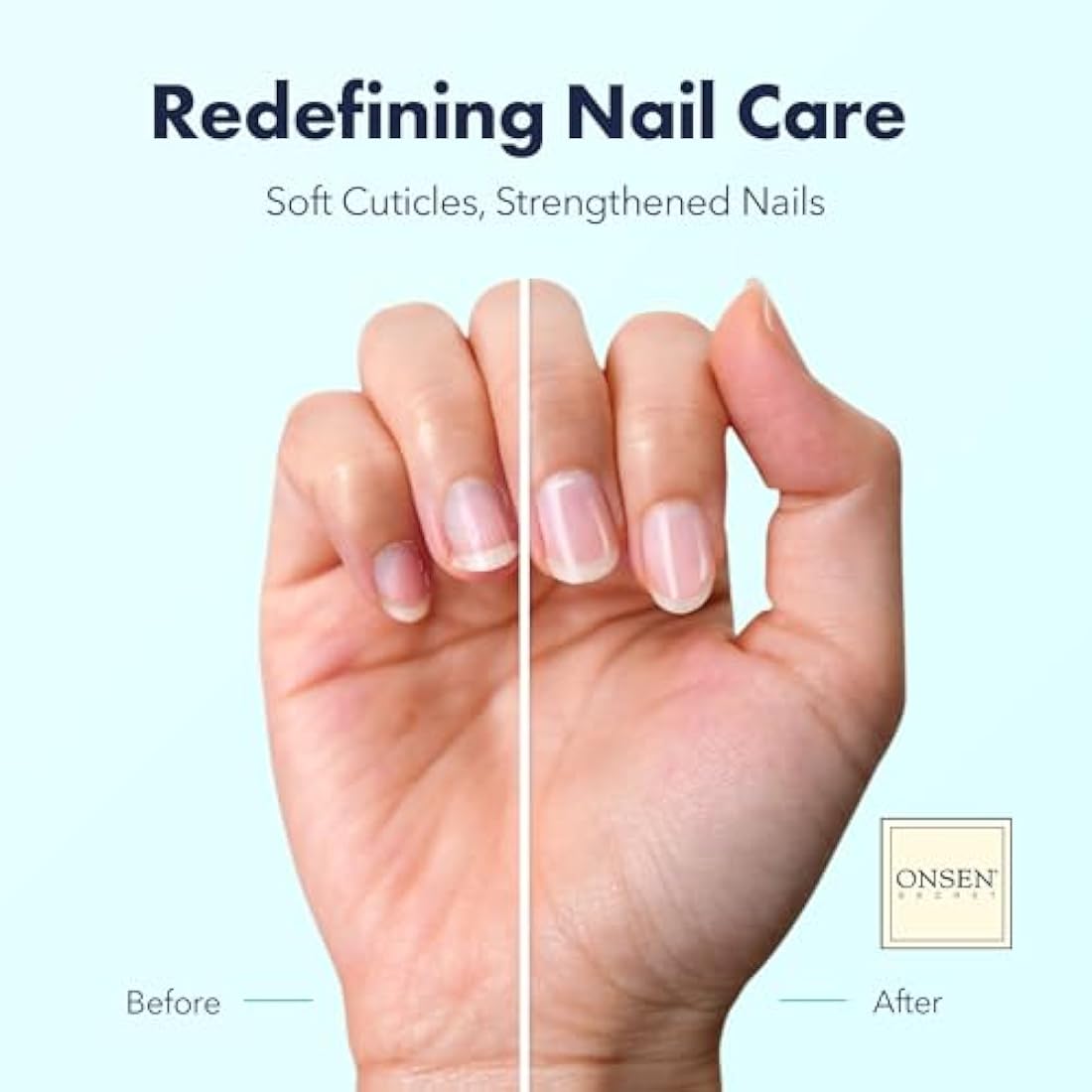 Organic Cuticle Oil for Nails - USA Made - Japanese Treatment for Damaged Nails - Natural Nail Cuticle Repair - Visible Results For Perfect Results - Nail Strengthener and Growth Reboot Oil 10ml