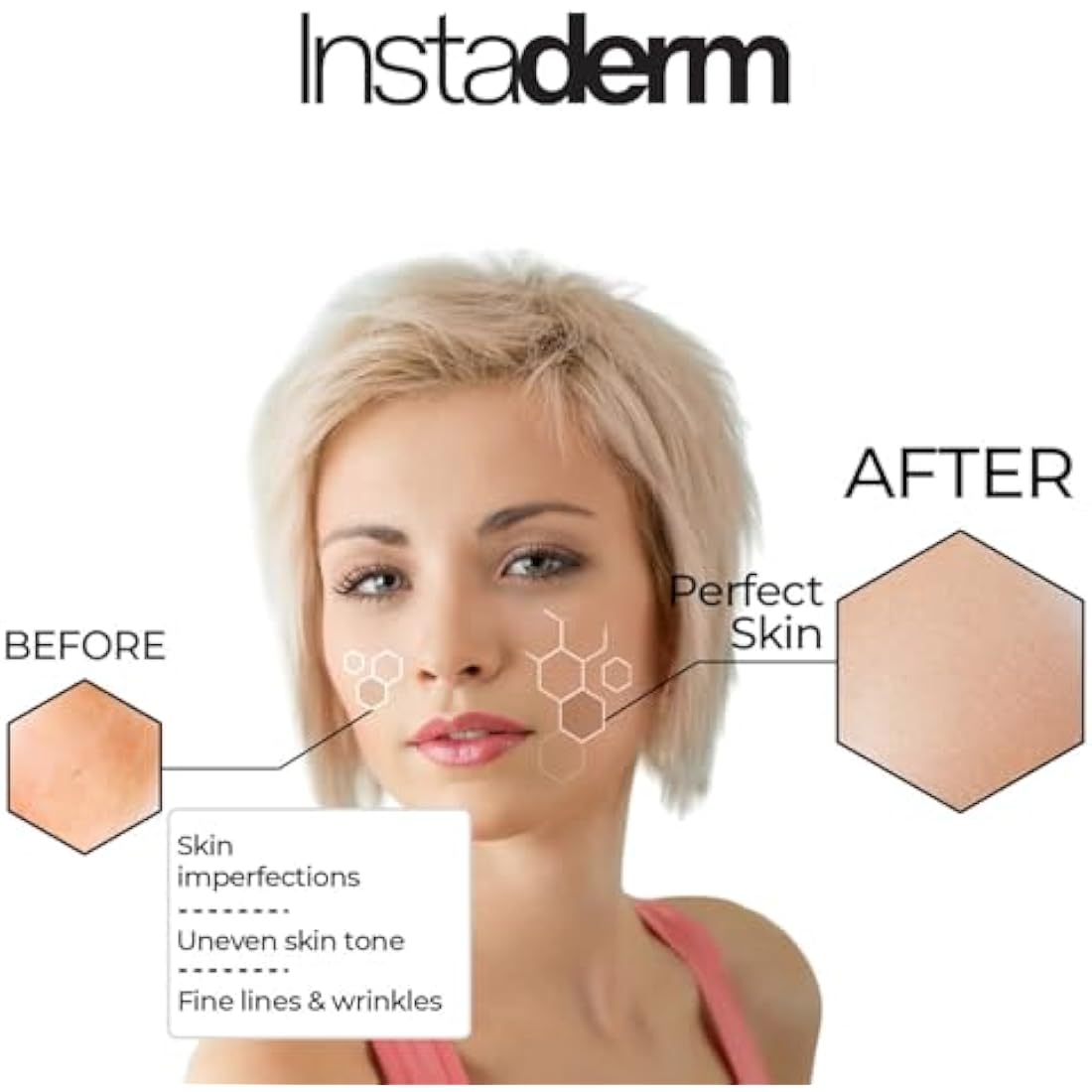 Brightening Exfoliating Peel Pads- Fades & Exfoliates Away Stubborn Dark Spots, Sunspots, Age Spots, Acne Scars & Freckles. Reverse Years of Damage Skin.