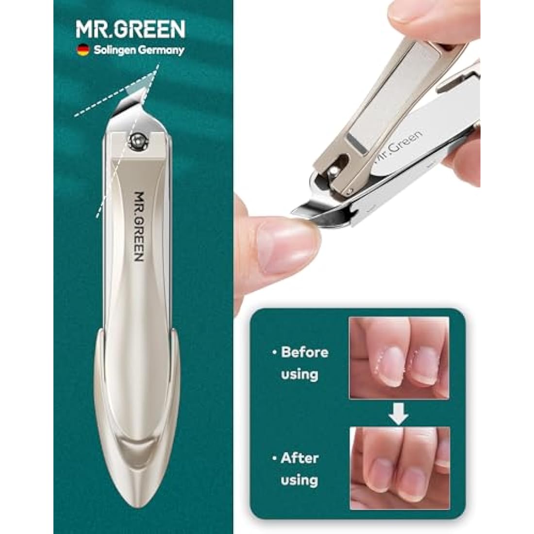 MR.GREEN 3pcs Nail Clipper Set, German Stainless Nail Clippers with Nail File& Catcher, Anti Splash Excellent Quality Nail Cutter, Professional Finger&Toenail Clippers with Leather Case for Men& Women