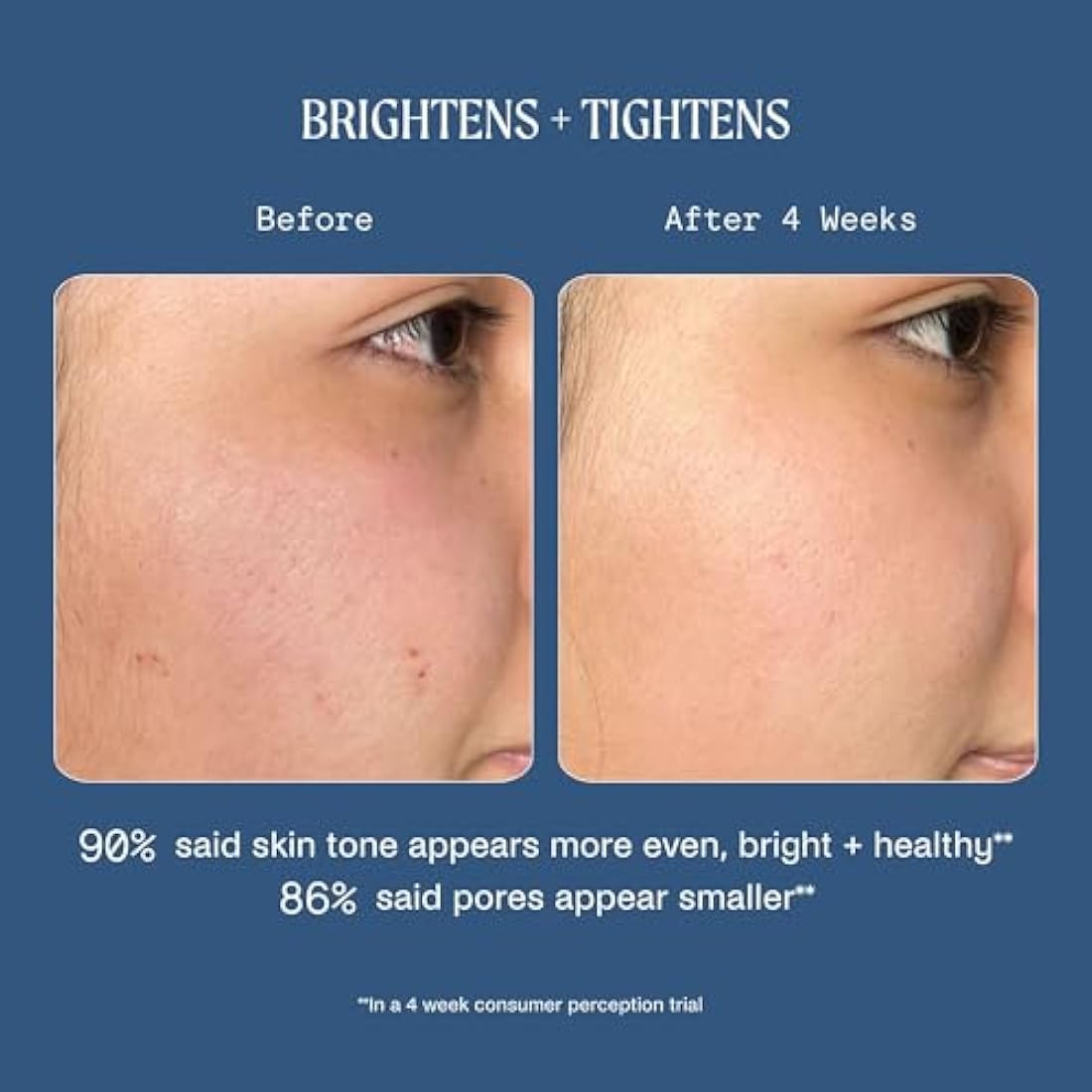 Kinship Dreamwave 2% Bio-Retinoid Overnight Renewal Serum - Retinol for Sensitive Skin - Smooth Wrinkles - Anti-Aging Niacinamide + Tranexamic Acid - Brighten, Moisturize, Reduce Redness (1 Oz)
