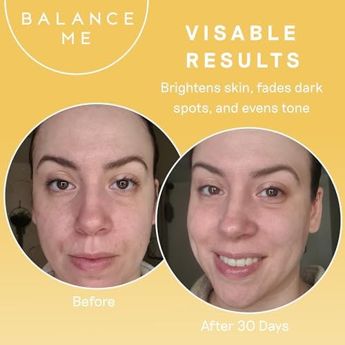 Balance Me Vitamin C Repair Serum 30ml, Hydrating Serum with Hyaluronic Acid and Collagen, Treatment for Hyperpigmentation, Dark Spots and Wrinkles