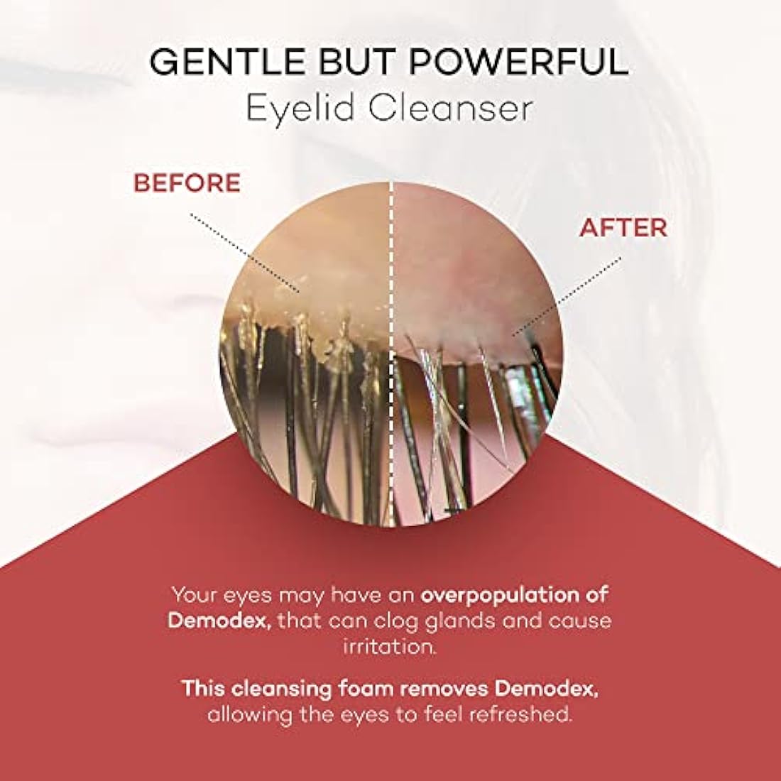 Zocular ZocuFoam Eyelid Cleanser 50ml - Foaming Eyelid Scrub for Blepharitis, Demodex and Inflammation - Stye Treatment for Eyes - Natural pH Balanced Treatment