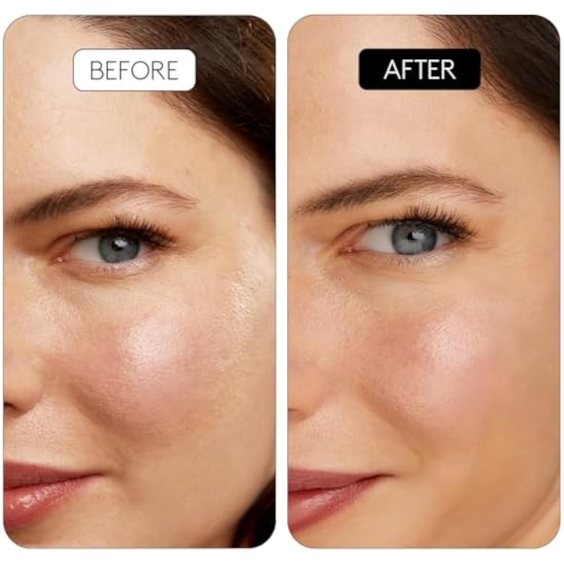 COCUNAT - CLINICAL RETINAL 0.1 - Vitamin A Retinal Serum - Reduces Wrinkles, Spots and Flaccidity - Regenerates and Rejuvenates - For All Skin Types - With Niacinamide and Hyaluronic Acid