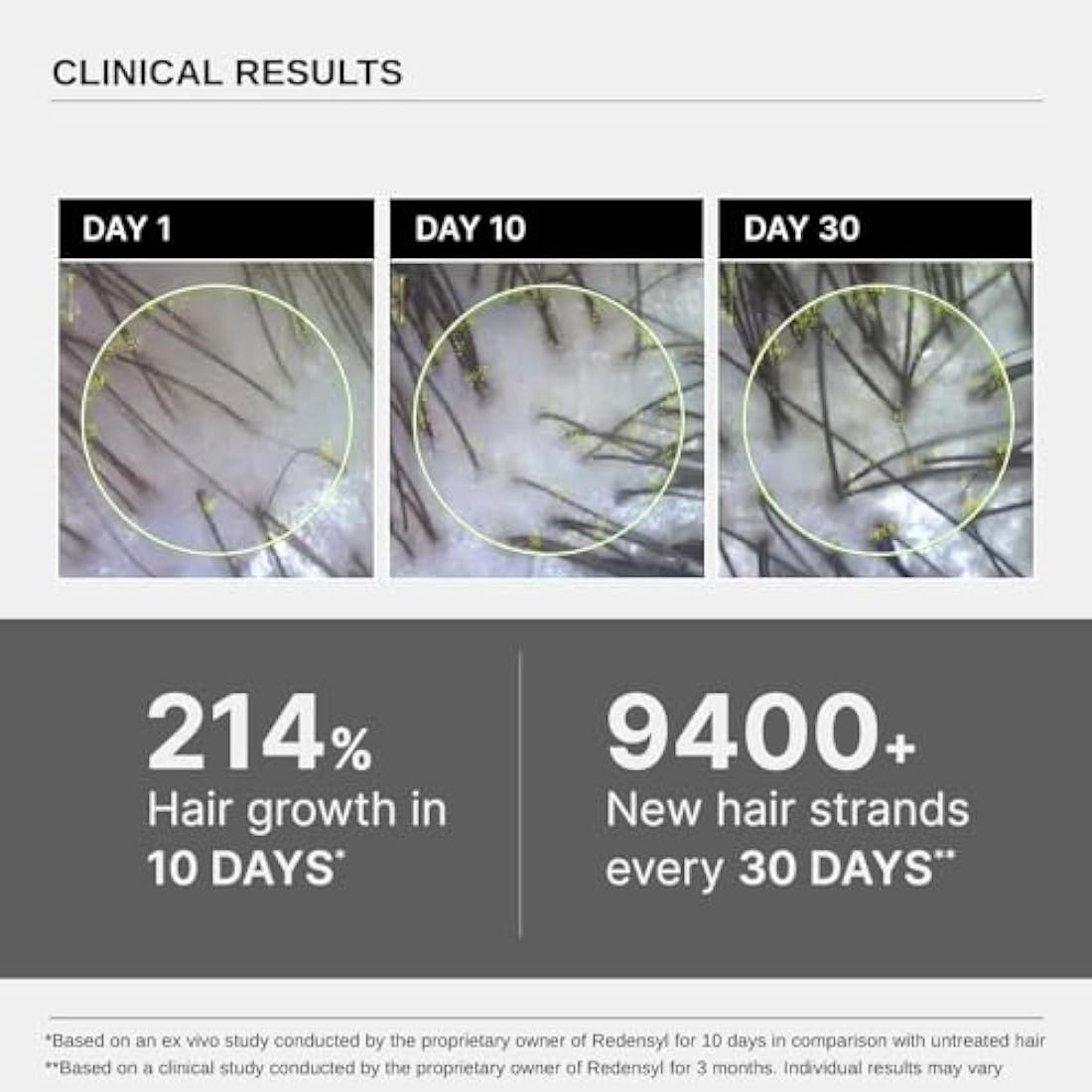 Bare Anatomy Advanced Hair Growth Serum | 3% Redensyl + 4% Anagain + 3% Baicapil + 1% Capilia Longa, Rosemary, Biotin & Rice Extract | Hair growth & Hair fall control serum for Women & Men | Pack of 3
