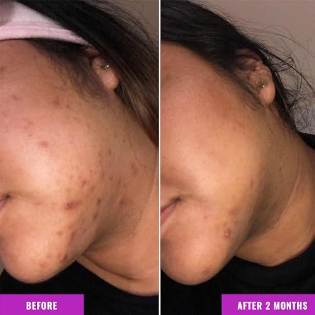 Good Molecules Discoloration Correcting Serum 75ML