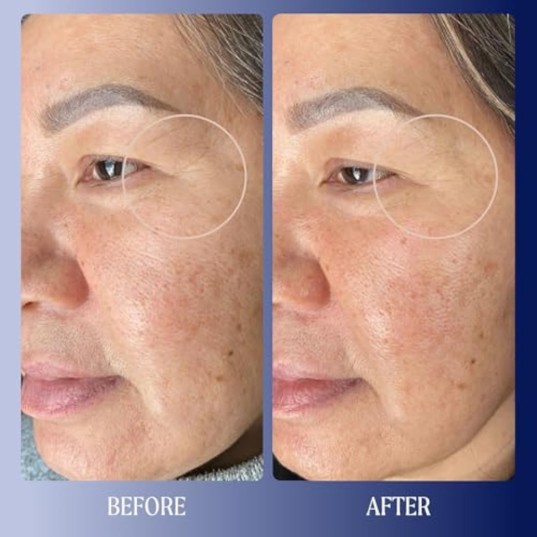 Kinship Dreamwave 2% Bio-Retinoid Overnight Renewal Serum - Retinol for Sensitive Skin - Smooth Wrinkles - Anti-Aging Niacinamide + Tranexamic Acid - Brighten, Moisturize, Reduce Redness (1 Oz)