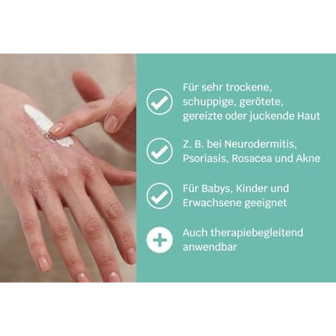 SIRIDERMA Acute Intensive Care Mask | Fragrance | Basic Cream Mask | 150 ml | Vegan Skin Care for Extremely Irritated and Flaking Skin