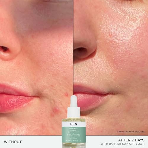 REN Evercalm Barrier Support Elixir – Strengthens Skin Barrier, Reduces Redness & Hydrates Sensitive Skin, 30ml