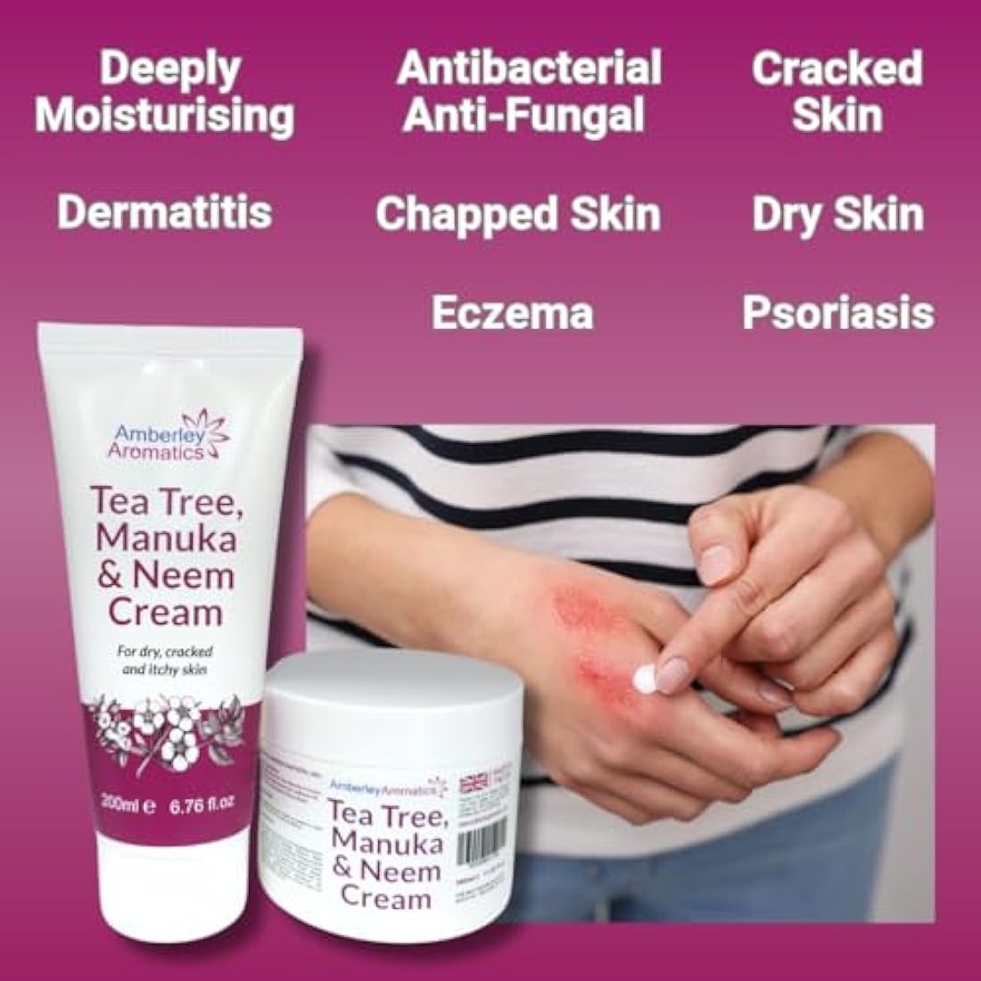 Tea Tree, Manuka & Neem Cream 350ml - Antibacterial, Anti-fungal, Antiseptic, Anti-Itch, Dry, Chapped & Cracked Skin, Eczema, Psoriasis, Jock Itch, Fungal infections. Fast Effective Relief