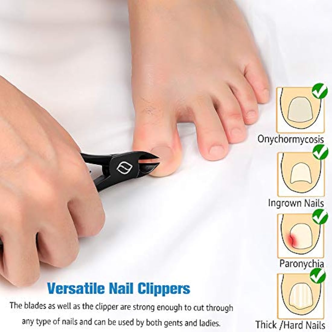 FERYES Toenail Clippers for Thick Nails, Toe Nail Clippers for Ingrown Hard Toe Nail Fingernail - Large Handle Stainless Steel Olecranon Fingernail Clipper, Black