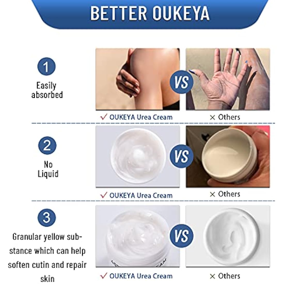 OUKEYA Urea Cream 40 Percent, Urea Foot & Hand Cream for Cracked Heels and Dry Skin, Urea Lotion for Deep Moisturizing, Callus Remover Nourishes Soften, Maximum Strength(150g (Pack of 4))
