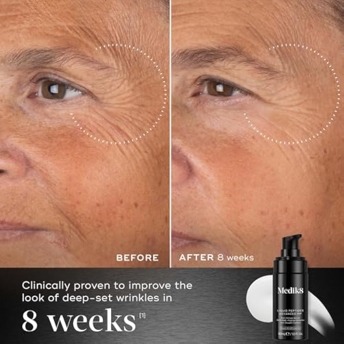 Medik8 Liquid Peptides Advanced MP - With Breakthrough Bio-Technology, Dual MiniProteins - 30% Multi-Peptide Complex - 30ml
