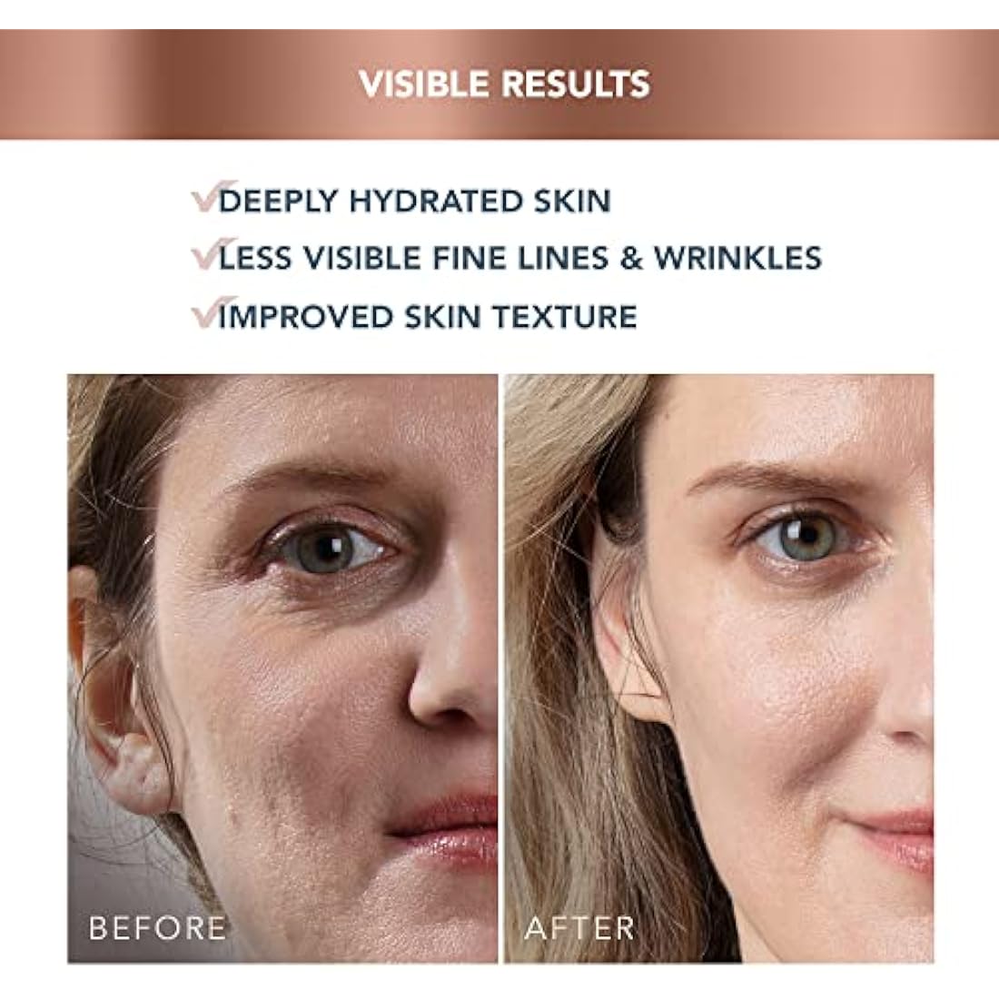 FOREO SUPERCHARGED HA+PGA Triple Action Intense Face Moisturiser - Wrinkle Day Cream for Face - Hyaluronic Acid & Squalane - Vegan - Cruelty & Gluten Free - Clean Skincare - 50ml