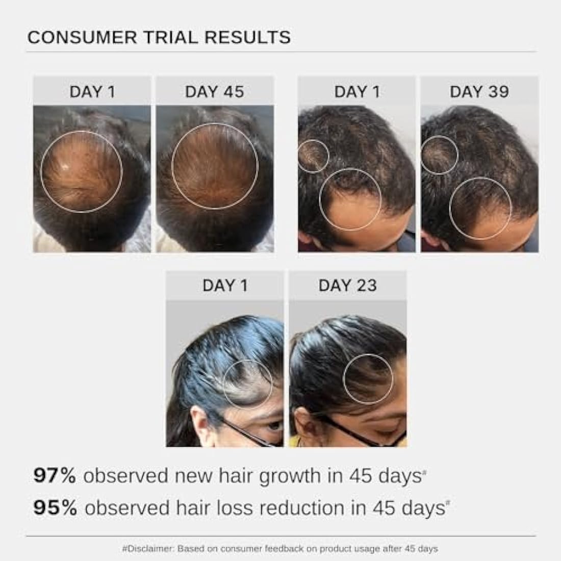 Bare Anatomy Advanced Hair Growth Serum | 3% Redensyl + 4% Anagain + 3% Baicapil + 1% Capilia Longa, Rosemary, Biotin & Rice Extract | Hair growth & Hair fall control serum for Women & Men | Pack of 3