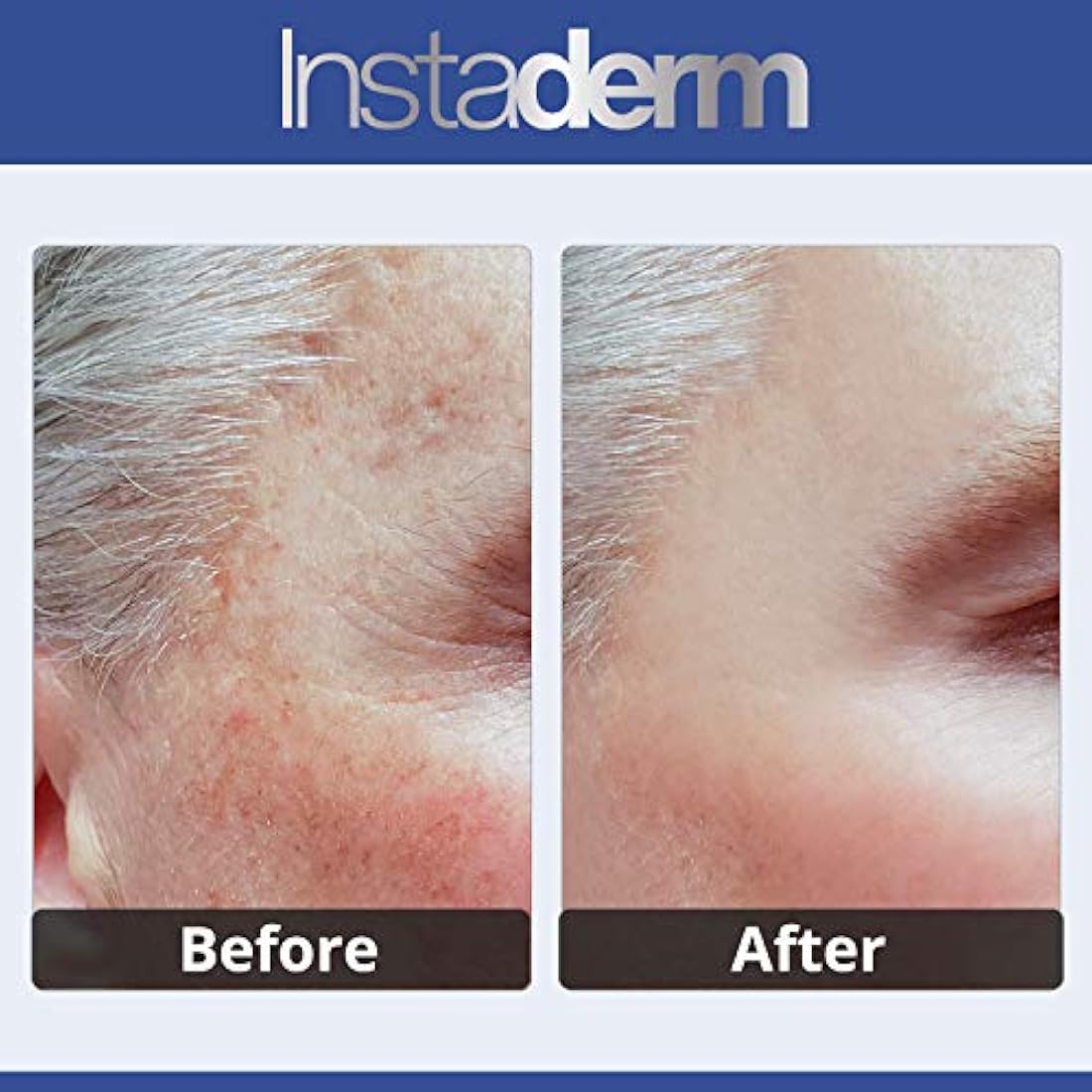 Dark Spot Corrector Cream- Naturally Fades Dark Spots, Sun Spots, Age Spots, Acne Blemish Scars, Brown Spots & Freckles for Brighter Lighter Hydrated Looking Skin.