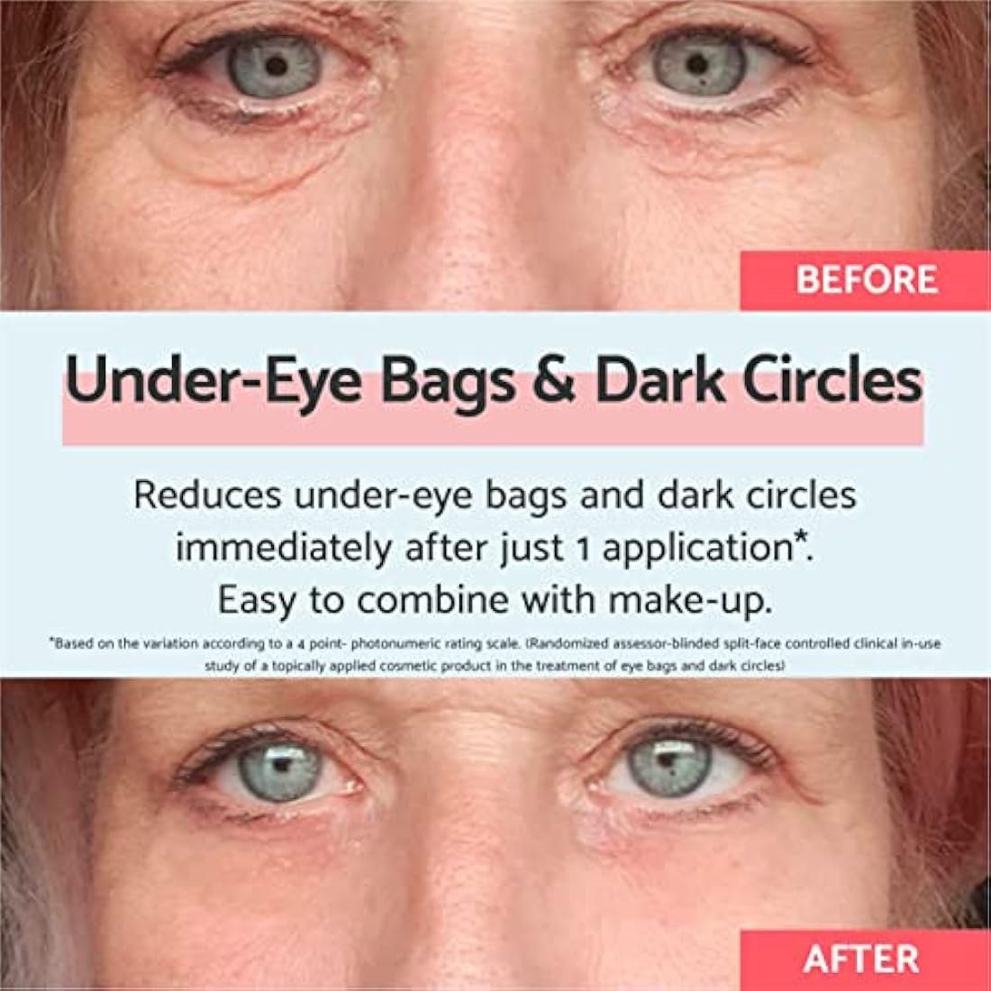 Remescar Eye Bags & Dark Circles Cream 8ml – Instant Eye Cream for Dark Circles & Puffiness – Reduces Bags Under Eyes in 2 Minutes – 180 Applications
