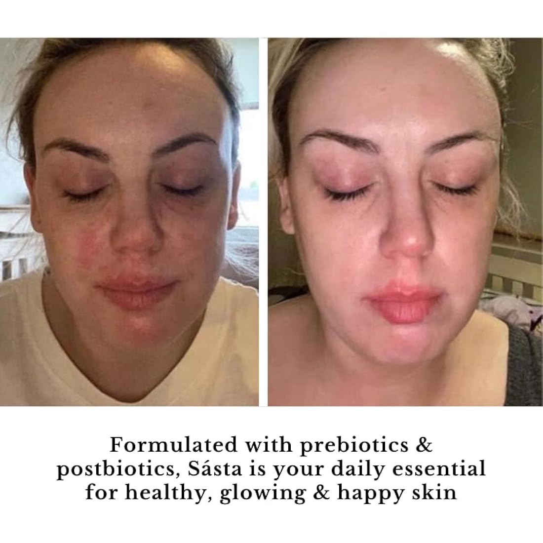 Sásta Microbiome Booster Serum – Prebiotic & Postbiotic Face Serum for Skin Barrier Repair, Hydration, & Anti-Redness, Suitable for All Skin Types 30ml