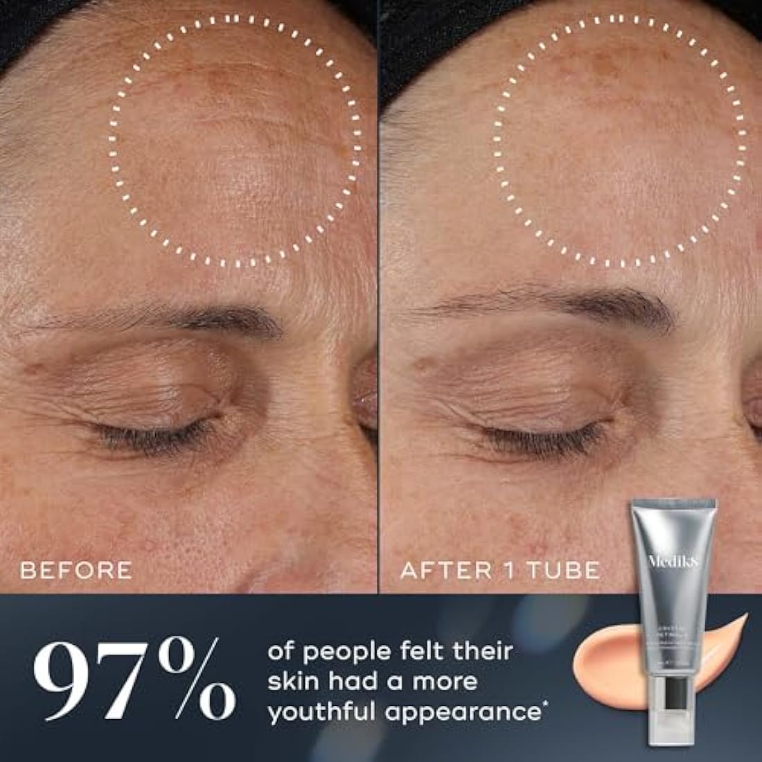 Medik8 Crystal Retinal 20 - Age-Defying Retinal Night Serum - Improves Wrinkles & Skin Firmness- 0.2% Retinal Strength - 11x Faster than Retinol - For Highly Experienced Vitamin A Users - 30ml