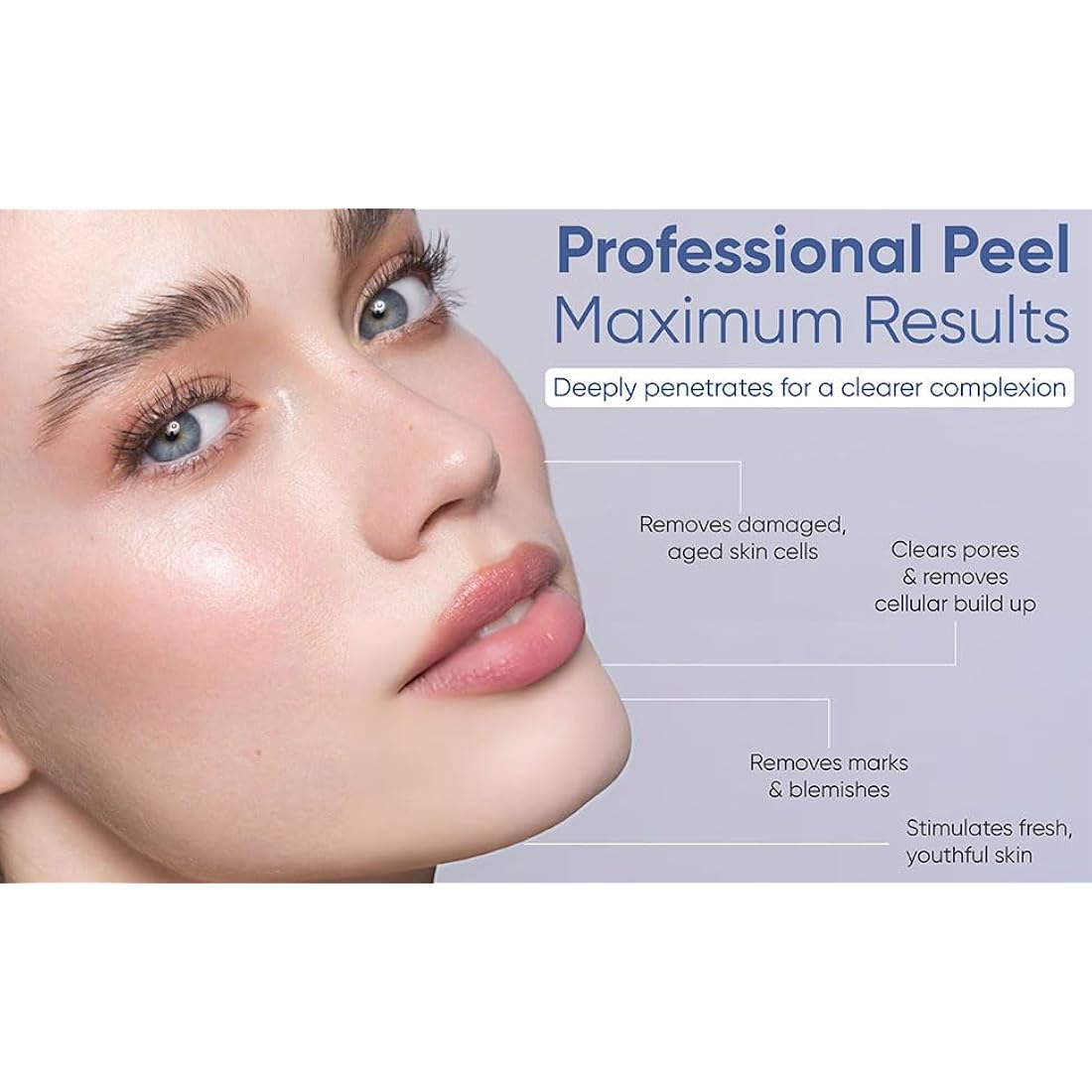 SKIN CULTURE PEEL 4000 - Skin Peeling Kit | Created in1937 | Gets rid of acne scars, blemishes, large pores, fine lines, sun damage in only 6 days!