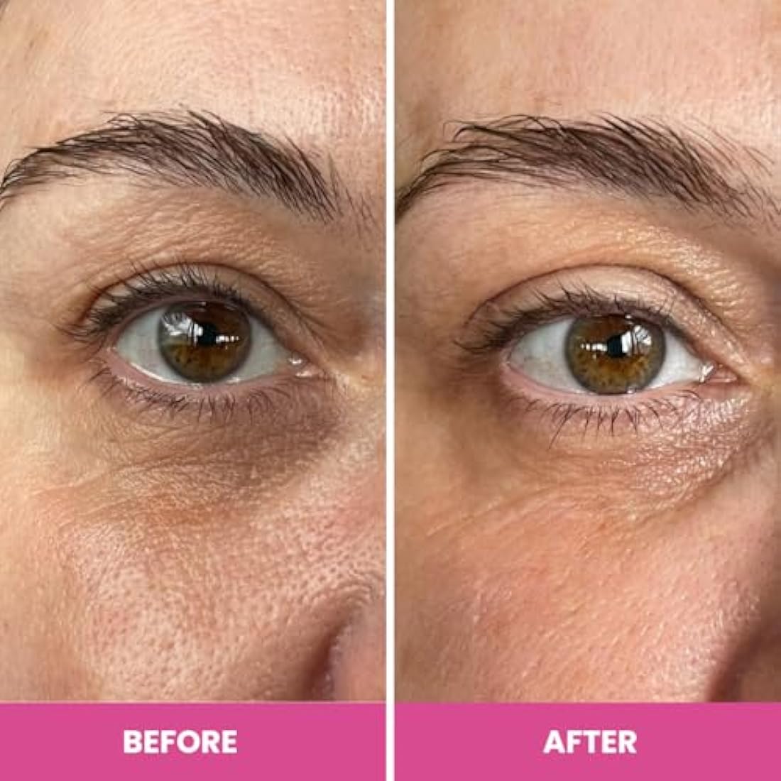 Prime Prometics PrimeEyes Hydrate Under Eye Cream for Mature Women – Hydrating Eye Cream for Dark Circles and Wrinkle Repair – Soft, Glowing & Healthy Under Eyes