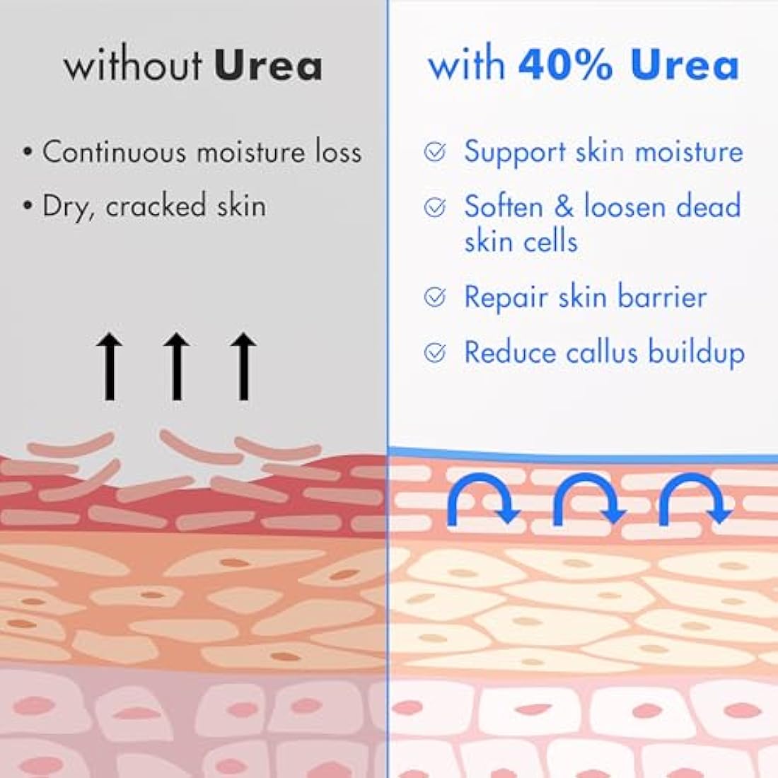 Urea Cream 40% Plus Salicylic Acid 4.6 oz, Callus Remover Hand Cream Foot Cream For Dry Cracked Feet, Hands, Heels, Elbows.