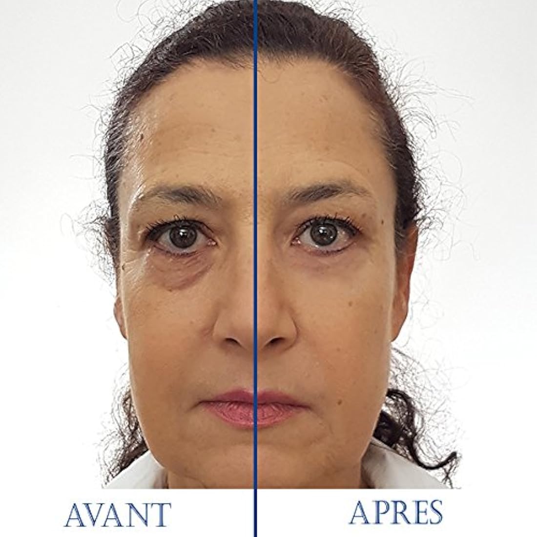SKINEANCE - Magic Serum - Eye contour tensing effect - Smoothes fine lines and wrinkles - Reduces puffiness under the eyes - Acts in less than 3 minutes - Effective 8 to 10 hours - 5 tubes of 2 ml...