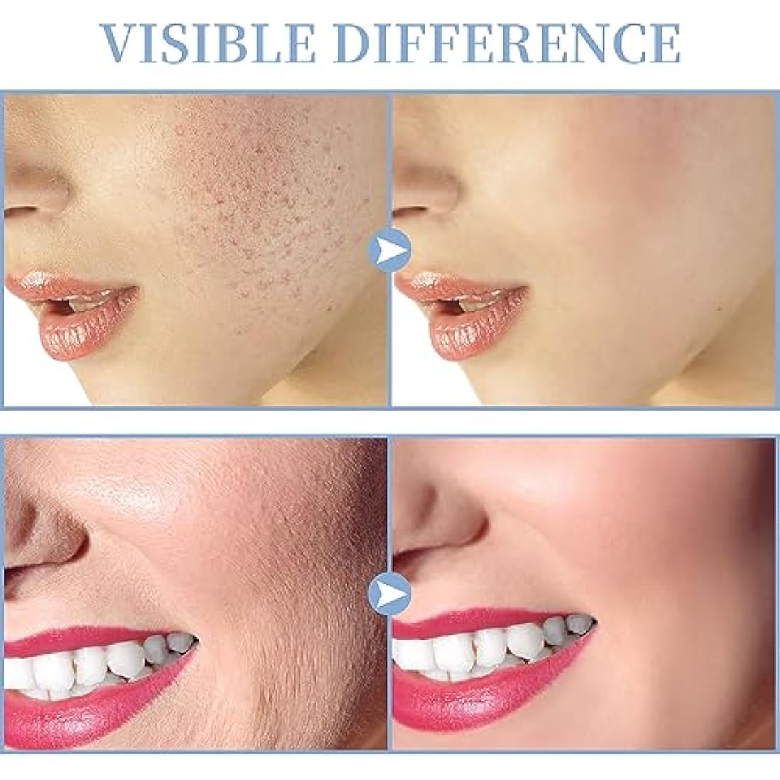 High Frequency Facial Machine, TUMAKOU Professional Portable Handheld Neon HF Face Wand, Light Therapy Facial Skin Tightening Machine Device with 4 Different Tubes