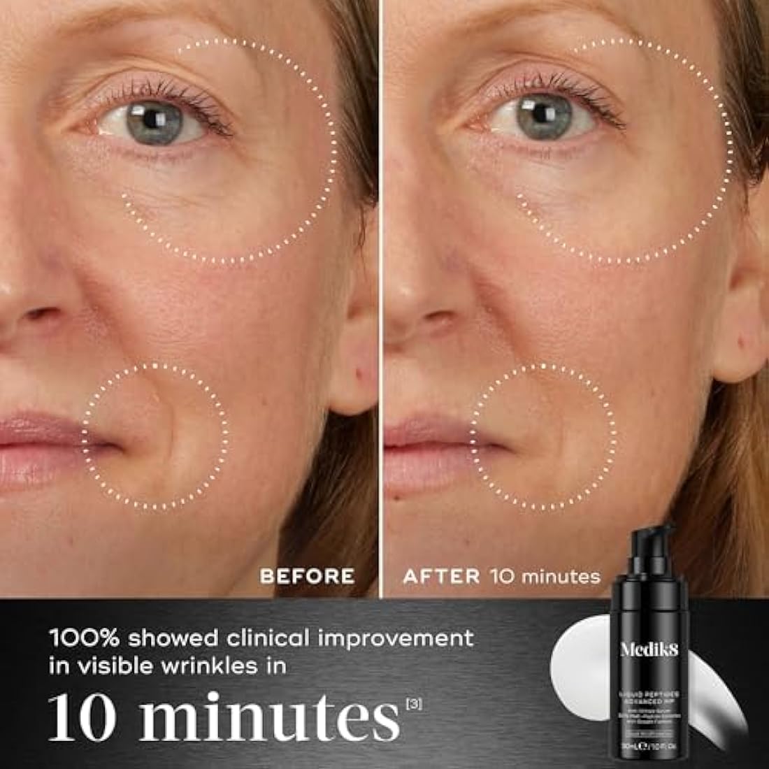Medik8 Liquid Peptides Advanced MP - With Breakthrough Bio-Technology, Dual MiniProteins - 30% Multi-Peptide Complex - 30ml