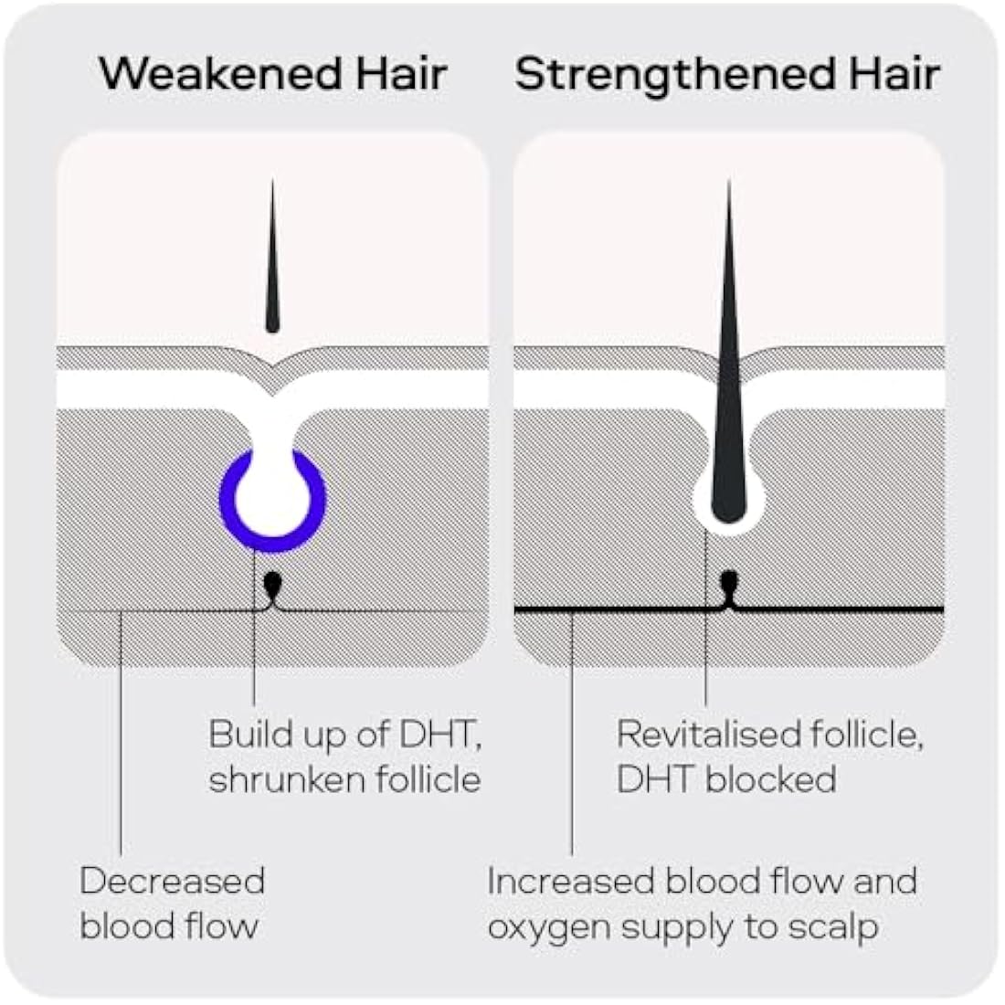 Sons Minoxidil 5%, Strengthening Shampoo and Dermaroller for Men. Hair Regrowth Treatment. Hair Growth Shampoo With Caffeine. Thickening, Anti-Dandruff, DHT Blocker. 1 Month Supply. Made in Europe.