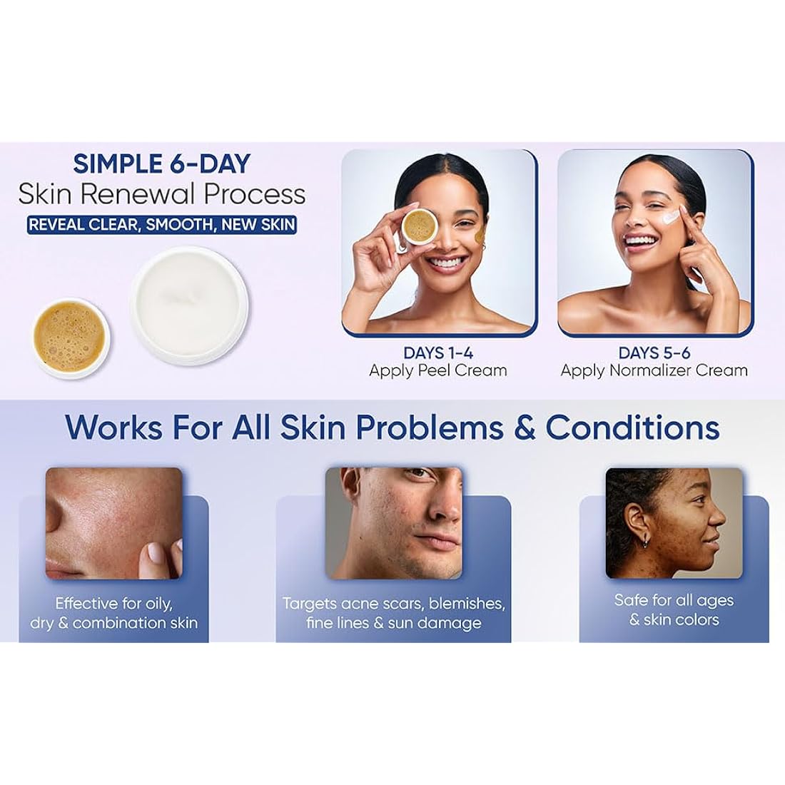 SKIN CULTURE PEEL 4000 - Skin Peeling Kit | Created in1937 | Gets rid of acne scars, blemishes, large pores, fine lines, sun damage in only 6 days!