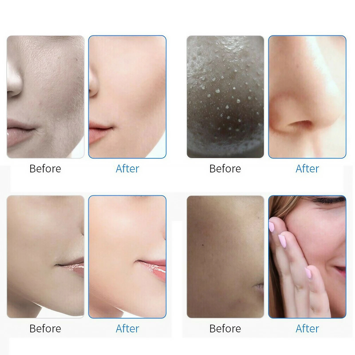 7 in 1 Aqua Hydra Hydro Peeling Facial Dermabrasion Machine Facial Skin Care