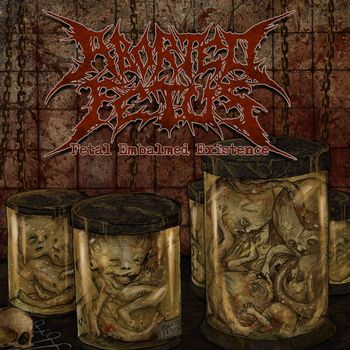 Aborted Fetus - Fetal Embalmed Existence
