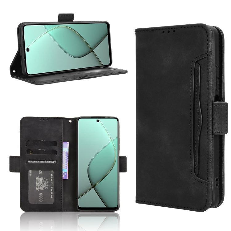 Skin Feel Calf Texture Card Slots Leather Phone Case, For Tecno Spark 30C 4G, For Tecno Spark 20 Pro 5G, For Tecno Camon 30 Premier 5G, For Tecno Pova 6 Neo 4G