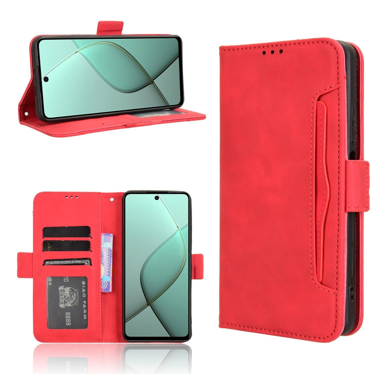 Skin Feel Calf Texture Card Slots Leather Phone Case, For Tecno Spark 30C 4G, For Tecno Spark 20 Pro 5G, For Tecno Camon 30 Premier 5G, For Tecno Pova 6 Neo 4G
