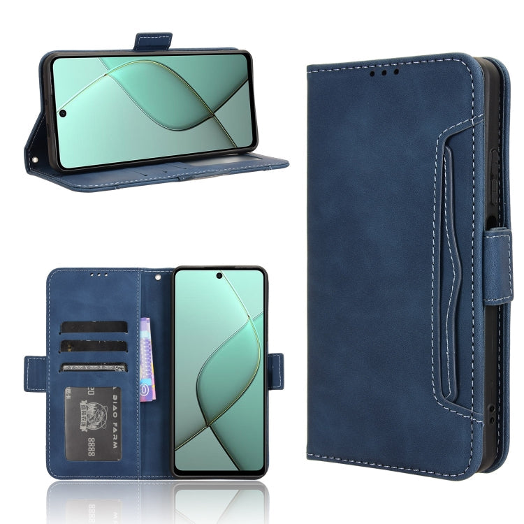 Skin Feel Calf Texture Card Slots Leather Phone Case, For Tecno Spark 30C 4G, For Tecno Spark 20 Pro 5G, For Tecno Camon 30 Premier 5G, For Tecno Pova 6 Neo 4G