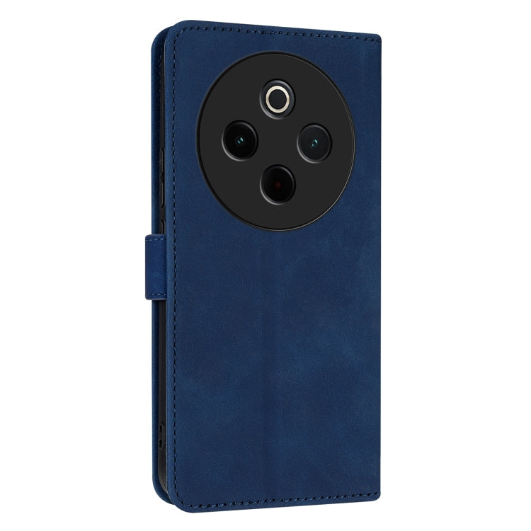 For vivo Y300 Pro AZNS Skin Feel Calf Texture Flip Leather Phone Case(Blue)