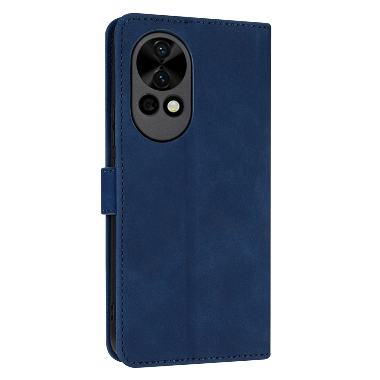 For Huawei nova 12 / nova 13 AZNS Skin Feel Calf Texture Flip Leather Phone Case(Blue)