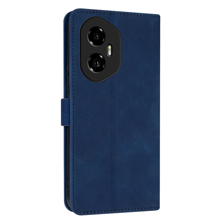 For Honor 300 AZNS Skin Feel Calf Texture Flip Leather Phone Case(Blue)