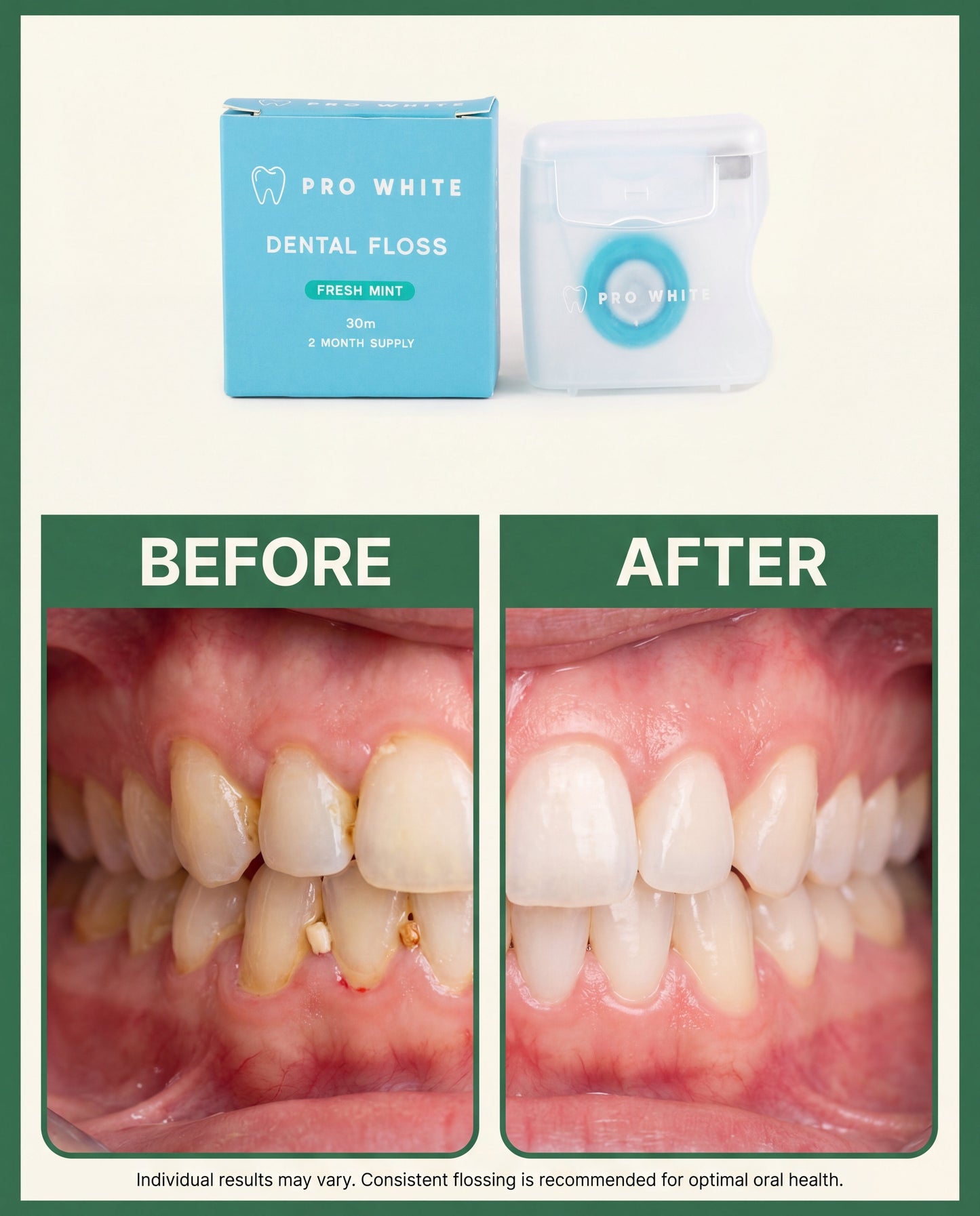 Pro White Eco Dental Floss