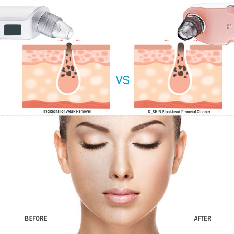 K-SKIN KD803A 3 Level Intensity Blackhead Removal Pore Cleaner Suction Rechargeable Black Spot Cleaner Facial Cleaning Machine