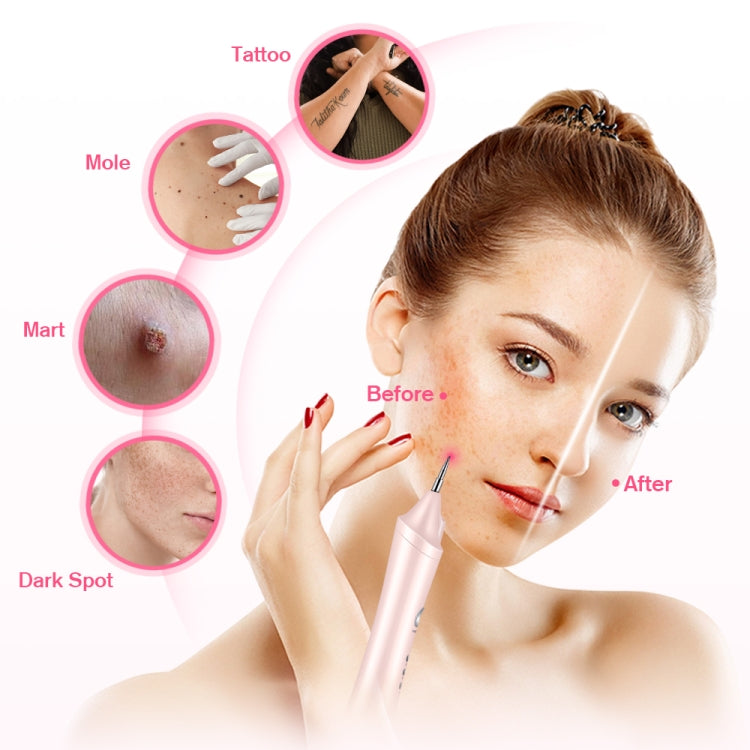 K-SKIN KD306 Laser Spotting Machine Plasma Pen Dark Eyelash Remover for Facial Spasm Removal Tattoo Skin Care(Pink)